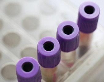 <b>首批儿童血液病定点医院公布</b>