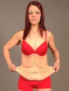 <b>英女子为婚礼狂减114斤致皮肤松垮如老妇</b>