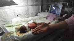 <b>出生时体重仅700克 内江＂巴掌仙女＂长大了(图)</b>