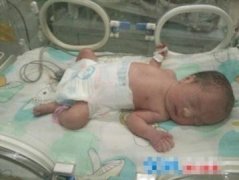 <b>352万分之一概率 巴中90后妈妈诞下四“千金”</b>