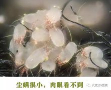 小螨虫大麻烦，军医教你如何应对螨虫过敏