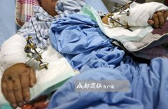 四川天台山：饲养员遭大熊猫疯狂撕咬 脚筋腕骨被咬断