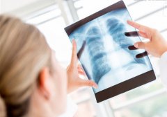<b>拍X光片为啥别守着门口</b>