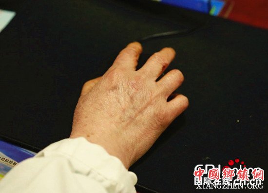已过审【新春走基层专题　要闻标题摘要】【网络媒体走转改】渝北区基层医生赵碛生：40年扎根群众 责任化于心【区县联动】【渝北】基层医生赵碛生：40年扎根群众 责任化于心【区县联动 二级页面】基层医生赵碛生：40年扎根群众