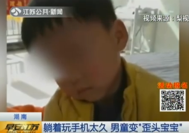 <b>湖南：躺着玩手机太久 男童变“歪头宝宝”</b>