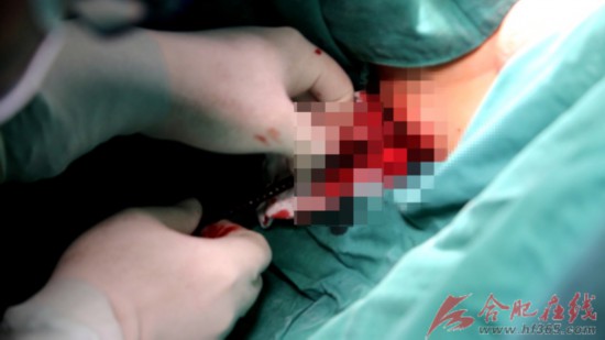 小心翼翼地取出钢筋